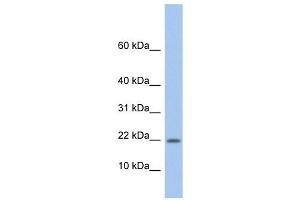 NDP antibody used at 1 ug/ml to detect target protein. (Norrie Disease (Pseudoglioma) Antikörper)