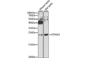 Western blot analysis of extracts of various cell lines, using CT45A3 antibody. (CT45A3 Antikörper)