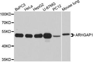 Western blot analysis of extracts of various cell lines, using ARHGAP1 antibody. (ARHGAP1 Antikörper  (AA 210-439))