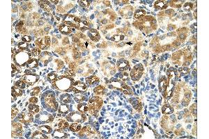 Immunohistochemistry (IHC) image for anti-TAM41, Mitochondrial Translocator Assembly and Maintenance Protein (TAMM41) (N-Term) antibody (ABIN2783108) (TAM41 Antikörper  (N-Term))