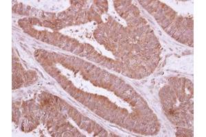 Image no. 1 for anti-NME Gene Family Member 9 (NME9) (AA 1-142) antibody (ABIN1501588) (NME9 Antikörper  (AA 1-142))