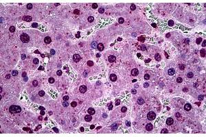 Human Liver: Formalin-Fixed, Paraffin-Embedded (FFPE) (SGK1 Antikörper  (AA 1-91))