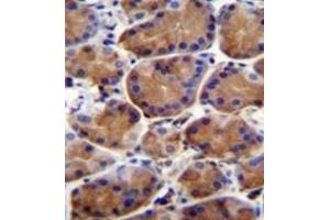 Immunohistochemistry (Paraffin-embedded Sections) (IHC (p)) image for anti-Leucine-Rich Repeat and WD Repeat-Containing Protein 1 (LRWD1) (AA 4-33), (N-Term) antibody (ABIN953241)
