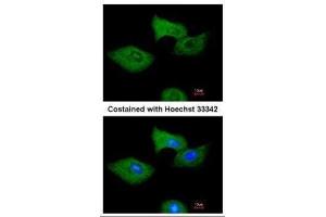 ICC/IF Image Immunofluorescence analysis of methanol-fixed A549, using RGS2, antibody at 1:200 dilution. (RGS2 Antikörper)