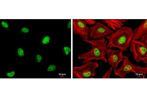 Immunofluorescence (IF) image for anti-Zinc Fingers and Homeoboxes 2 (ZHX2) (C-Term) antibody (ABIN2856852)