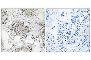 Immunohistochemistry (IHC) image for anti-Ubiquitin Specific Peptidase 13 (Isopeptidase T-3) (USP13) (C-Term) antibody (ABIN1852328) (USP13 Antikörper  (C-Term))