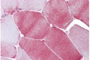 Immunohistochemistry (IHC) image for anti-Fatty Acid Binding Protein 3, Muscle and Heart (FABP3) (AA 72-121) antibody (ABIN6748608)