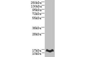 Western blot All lanes: MTHFD2L antibody at 6 μg/mL + Mouse lung tissue Secondary Goat polyclonal to rabbit IgG at 1/10000 dilution Predicted band size: 38, 32, 8, 25, 33 kDa Observed band size: 14 kDa (MTHFD2L Antikörper  (AA 136-268))
