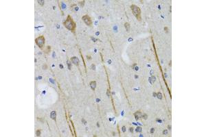 Immunohistochemistry of paraffin-embedded mouse brain using HTR3A antibody (ABIN5973293) at dilution of 1/100 (40x lens). (Serotonin Receptor 3A Antikörper)