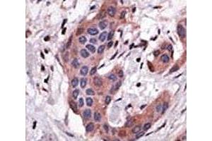 Immunohistochemistry (IHC) image for anti-BH3 Interacting Domain Death Agonist (BID) (AA 68-103) antibody (ABIN3028508)