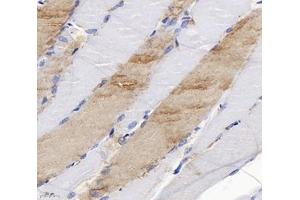 Immunohistochemistry analysis of paraffin-embedded rat skeletal muscle using SLC6A8 (ABIN7075678) at dilution of 1: 400 (SLC6A8 Antikörper)