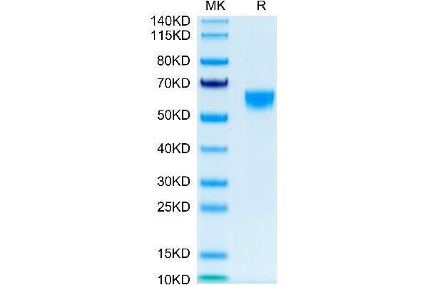 IL-9 Protein (AA 19-144) (Fc Tag)