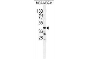 Western blot analysis of CTSS antibody in MDA-MB231 cell line lysates (35ug/lane) (Cathepsin S Antikörper  (AA 210-240))