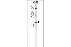 CH Antibody (Center) (ABIN651719 and ABIN2840373) western blot analysis in K562 cell line lysates (15 μg/lane). (PMCH Antikörper  (AA 94-122))