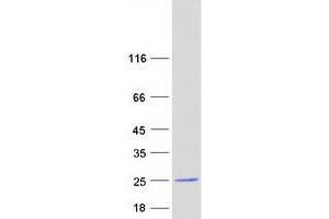 Validation with Western Blot (COPZ1 Protein (Myc-DYKDDDDK Tag))