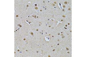 Immunohistochemistry of paraffin-embedded rat brain using ILK Antibody. (ILK Antikörper  (AA 1-260))