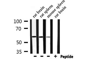 Western blot analysis of extracts from rat brain, rat spleen, mouse spleen, using RASGEF1B Antibody.