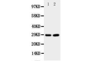 Western Blotting (WB) image for anti-Prion Protein (PRNP) (AA 143-159), (Middle Region) antibody (ABIN3044180) (PRNP Antikörper  (Middle Region))