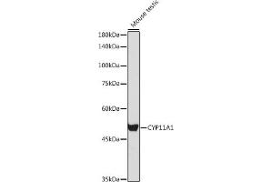 Western blot analysis of extracts of Mouse testis, using CYP11 antibody (6363) at 1:1000 dilution. (CYP11A1 Antikörper  (AA 40-320))