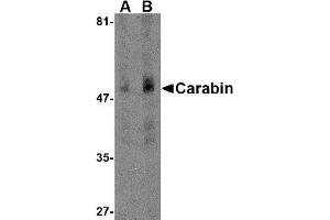 Western Blotting (WB) image for anti-TBC1 Domain Family, Member 10C (TBC1D10C) (N-Term) antibody (ABIN1031291) (Carabin Antikörper  (N-Term))
