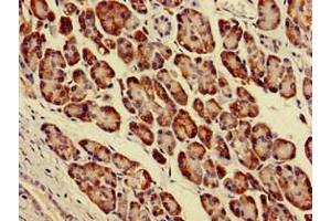 Immunohistochemistry of paraffin-embedded human pancreatic tissue using ABIN7143927 at dilution of 1:100 (Parvin alpha Antikörper  (AA 2-94))