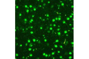 Immunofluorescence (IF) image for anti-Minichromosome Maintenance Complex Component 2 (MCM2) (AA 889-904), (C-Term) antibody (ABIN3044242)