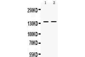 Western blot analysis of TRPM4 expression in mouse spleen extract (lane 1) and SW620 whole cell lysates (lane 2). (TRPM4 Antikörper  (AA 1079-1214))