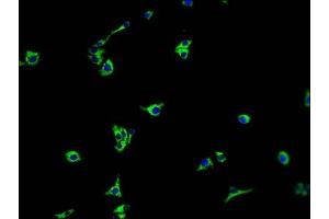 Immunofluorescence staining of HepG2 cells with ABIN7140231 at 1:100, counter-stained with DAPI. (TMEM37 Antikörper  (AA 4-20))