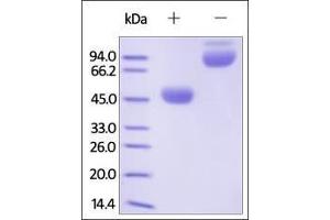 Human CTLA-4, Fc Tag on SDS-PAGE under reducing (R) and no-reducing (NR) conditions.