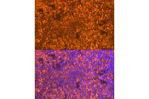 Immunofluorescence analysis of Mouse spleen using FB antibody (ABIN6129339, ABIN6140465, ABIN6140466 and ABIN6224941) at dilution of 1:100. (FAM65B Antikörper  (AA 1-210))