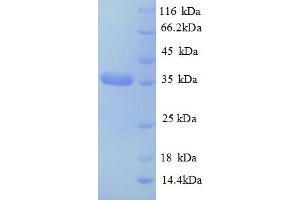 SDS-PAGE (SDS) image for Caspase 14, Apoptosis-Related Cysteine Peptidase (CASP14) (AA 153-240) protein (GST tag) (ABIN5709199)
