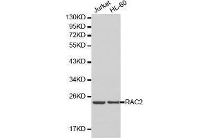 Western blot analysis of Jurkat cell and HL-60 cell lysate using RAC2 antibody.