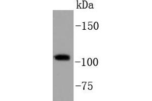 HeLa cell lysates, probed with PI3-kinase p110 subunit beta (34F12) Monoclonal Antibody  at 1:1000 overnight at 4˚C. (PIK3CB Antikörper)