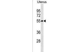 LRRIQ4 Antibody (N-term) (ABIN1538898 and ABIN2838169) western blot analysis in Uterus tissue lysates (35 μg/lane). (LRRIQ4 Antikörper  (N-Term))