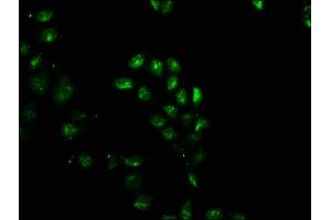 Immunofluorescence staining of Hela cells with ABIN7153753 at 1:100, counter-stained with DAPI. (SIP1 Antikörper  (AA 1-280))