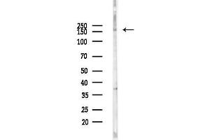 anti-WD Repeat Domain 19 (WDR19) (N-Term) antibody