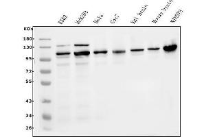Western blot analysis of ERK5/MAPK7 using anti-ERK5/MAPK7 antibody (ABIN7600701).