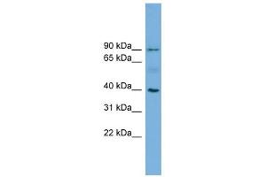 HFE antibody used at 1 ug/ml to detect target protein. (HFE Antikörper  (N-Term))