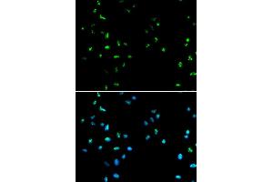 Immunofluorescence analysis of A549 cells using HDAC4 antibody (ABIN5970069). (HDAC4 Antikörper)