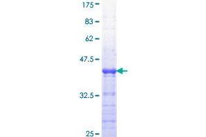 APC Protein (AA 2744-2843) (GST tag)