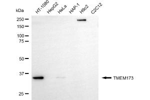 Western blotting analysis using TMEM173 antibody (ABIN7800620). (Rekombinanter STING/TMEM173 Antikörper)