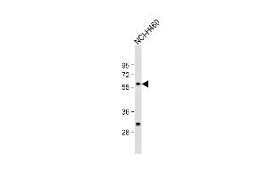 Anti-CARS2 Antibody (C-term) at 1:1000 dilution + NCI- whole cell lysate Lysates/proteins at 20 μg per lane. (CARS2 Antikörper  (C-Term))