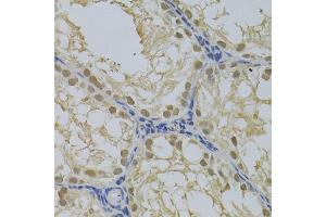 Immunohistochemistry of paraffin-embedded rat testis using DNMT3A Antibody (ABIN1872325) at dilution of 1:100 (40x lens). (DNMT3A Antikörper)
