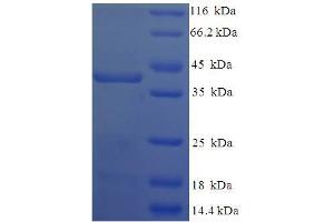TGFB-Induced Factor Homeobox 2-Like, X-Linked (TGIF2LX) (AA 1-241), (full length) protein (His-SUMO Tag)