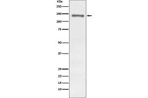 Western blot analysis of Raptor expression in MCF-7 cell lysate.