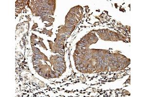 IHC analysis of TAB2 using anti-TAB2 antibody (ABIN7600244).
