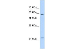 WB Suggested Anti-CAV1 Antibody Titration:  1. (Caveolin-1 Antikörper  (N-Term))