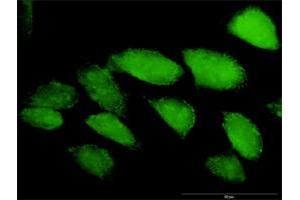 Immunofluorescence (IF) image for anti-Caspase 3 (CASP3) (AA 1-277) antibody (ABIN949992)
