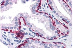 Human Prostate: Formalin-Fixed, Paraffin-Embedded (FFPE) (KRT81 Antikörper  (AA 1-203))