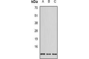 Western blot analysis of RPS20 expression in SHSY5Y (A), MCF7 (B), HEK293T (C) whole cell lysates.